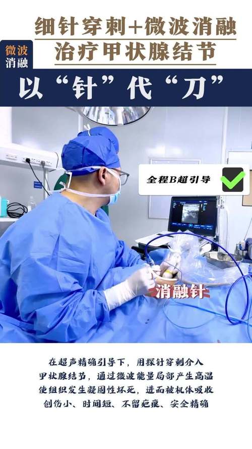 微创消融术治疗甲状腺结节安全吗