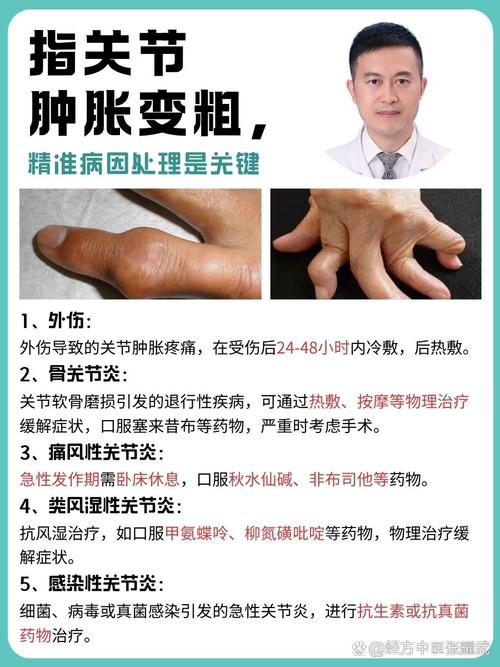 痛风性关节炎怎么快速消肿