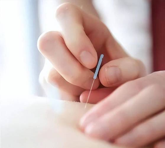 风湿性关节炎的针灸治疗