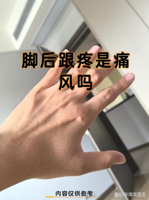 痛风脚后跟疼还能锻炼吗
