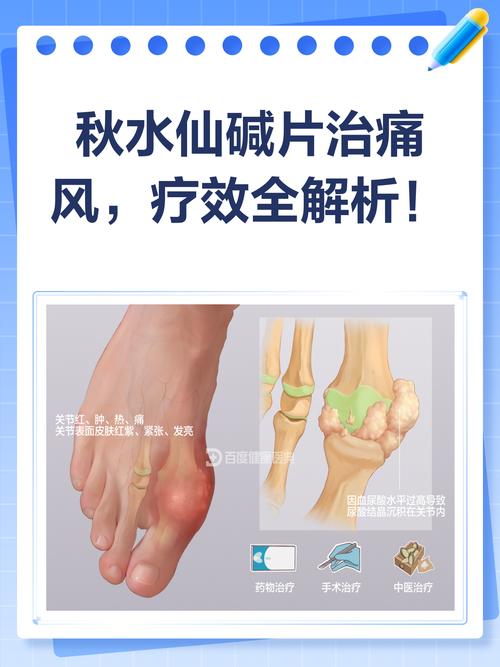 秋水仙碱治痛风效果好吗