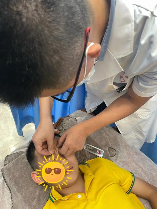 宝宝面瘫针灸多久会好