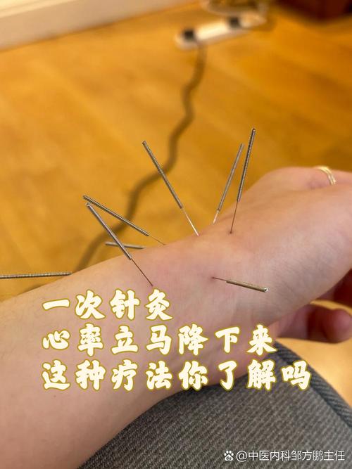 针灸多久可以治好胃病