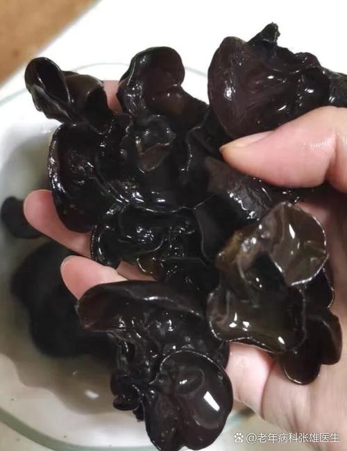 痛风病人可以吃黑木耳吗