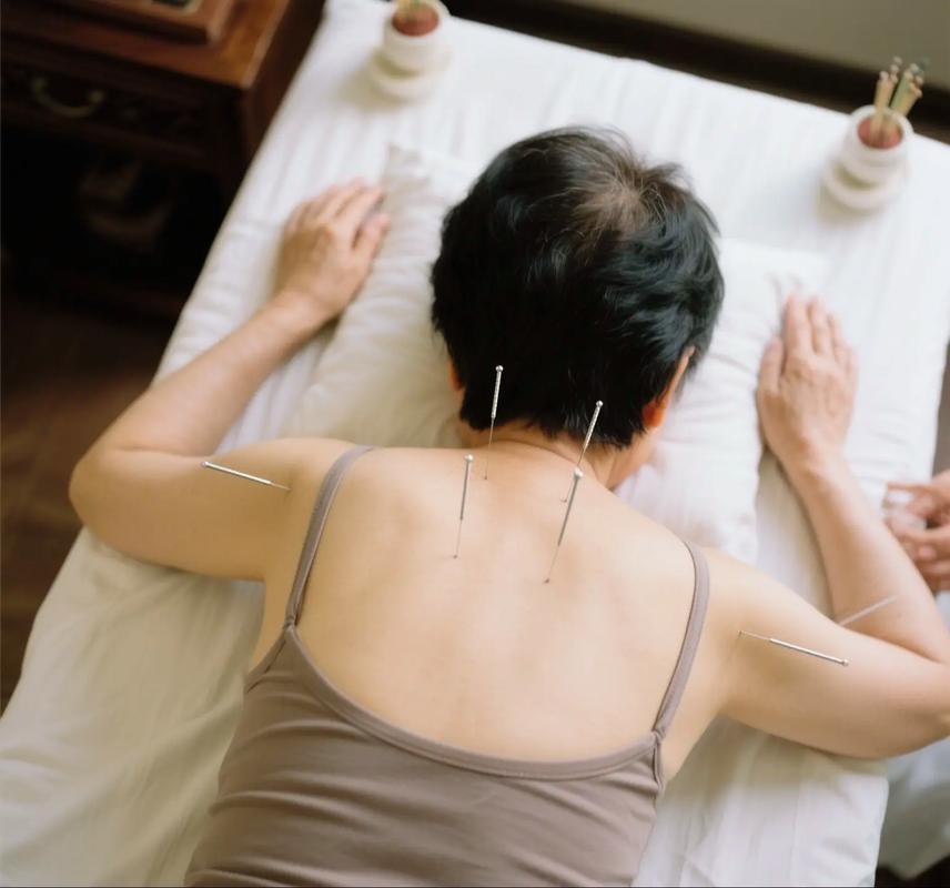 手脚发麻针灸能否治疗