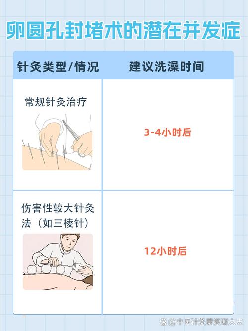 针灸多久以后可以洗澡