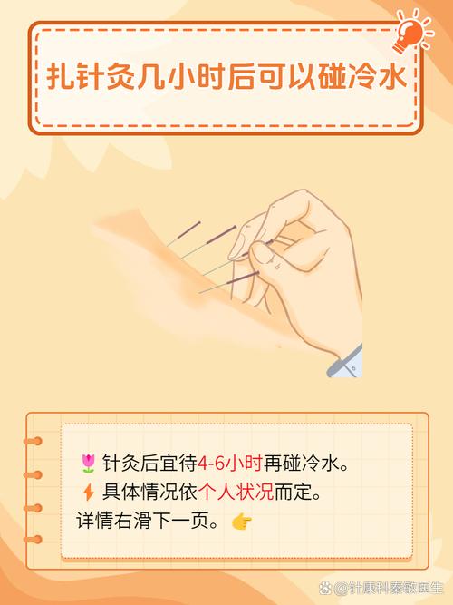 针灸多久以后可以洗澡