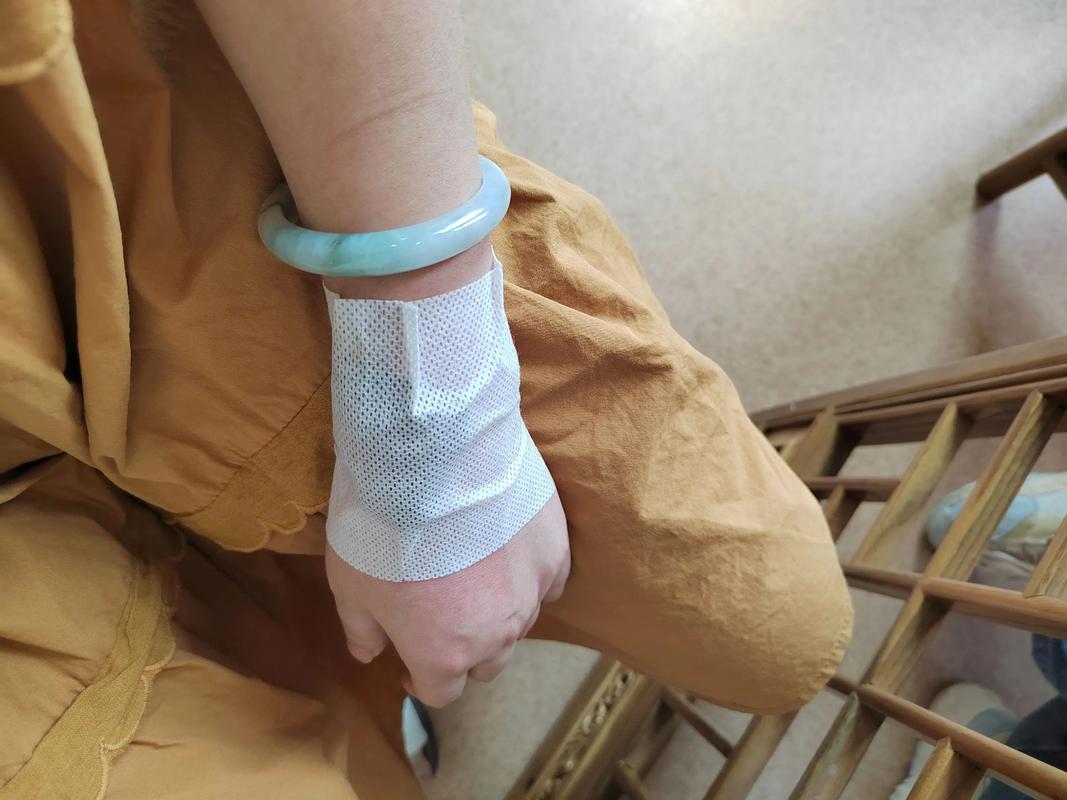 右侧肢体瘫痪如何针灸