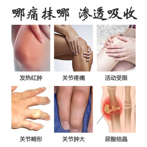 痛风灵和风痛灵一样吗