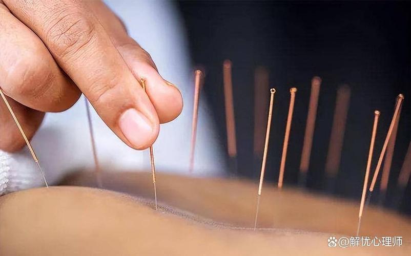 乳房针灸视频教学视频