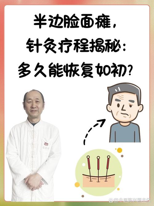 针灸治疗面瘫 pdf
