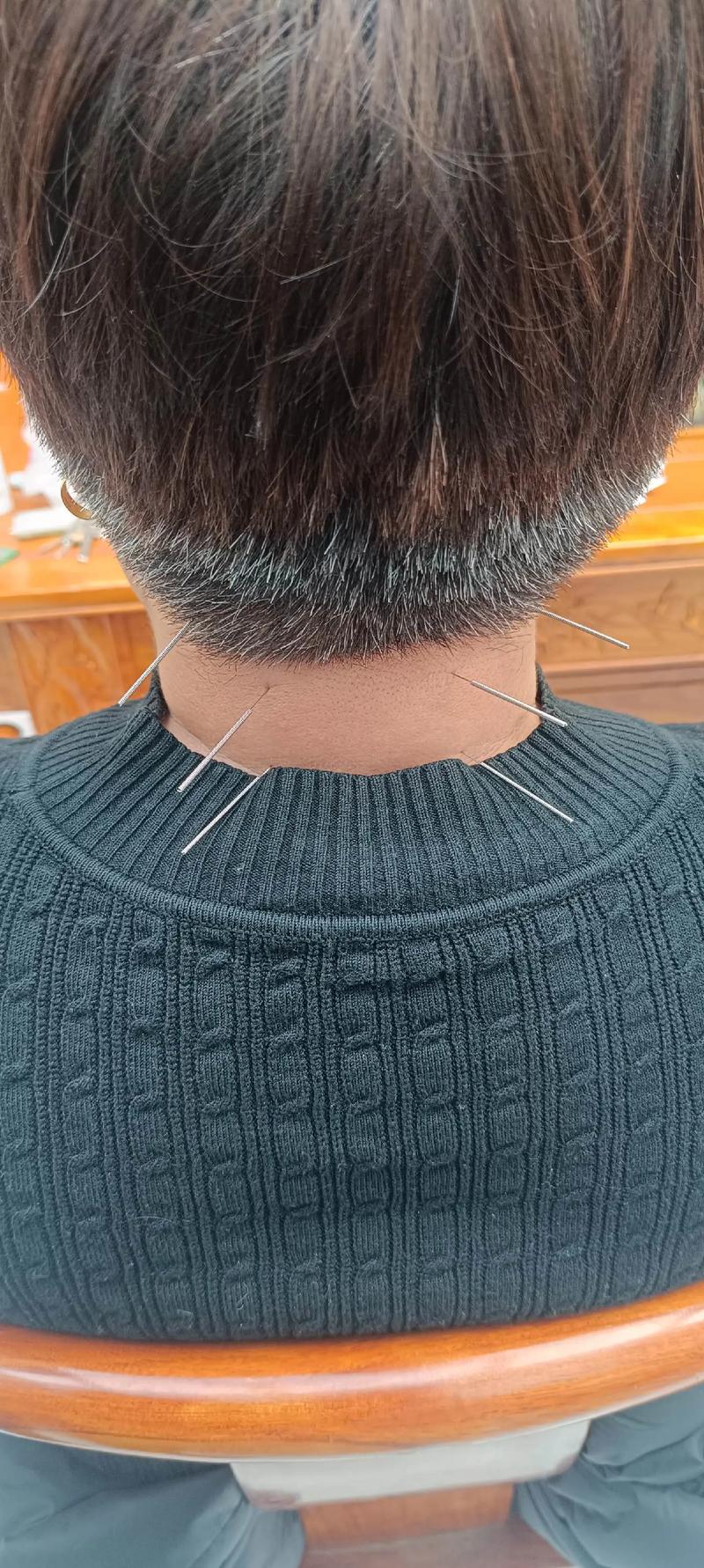 李建军一分钟针灸减肥