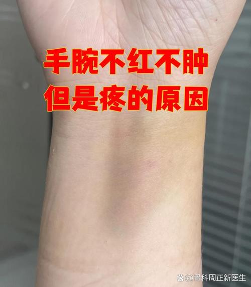 痛风能引起手腕子痛吗