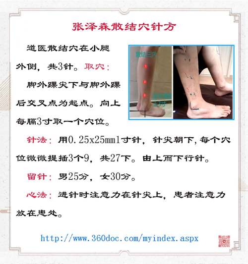 乳腺增生可不可以针灸