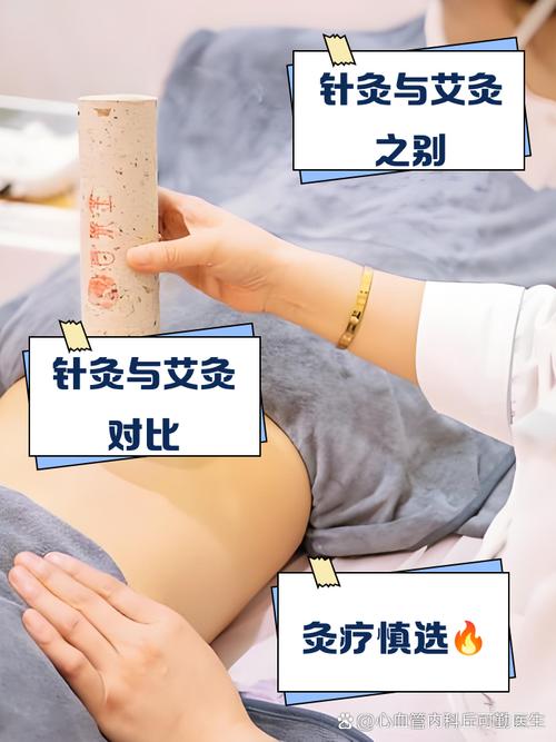 针灸和艾灸一起可以吗