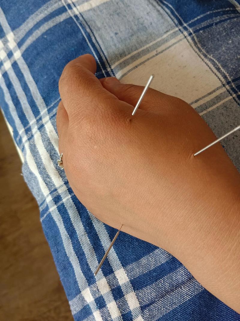 南京市中医院有针灸吗