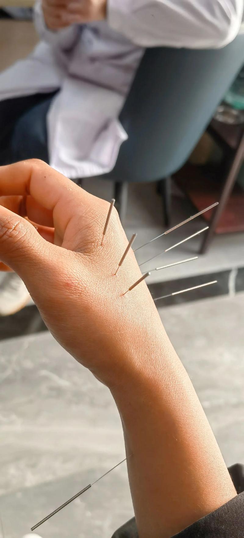 大连中医院针灸怎么样