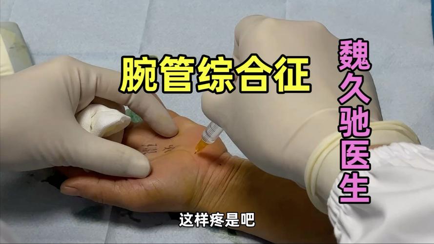 腕管综合症针灸有用吗