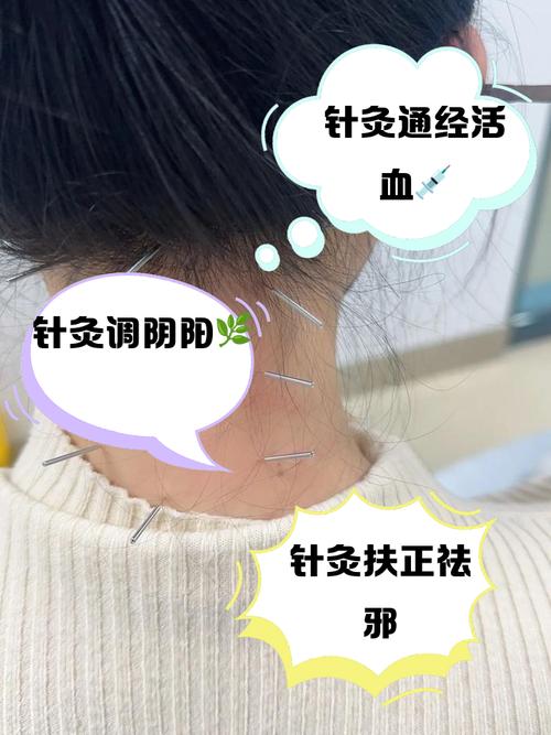 针灸能治过敏性紫癜吗