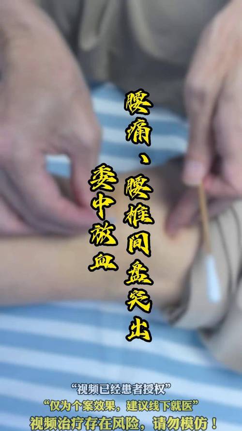 腰椎间盘突出针灸疗法