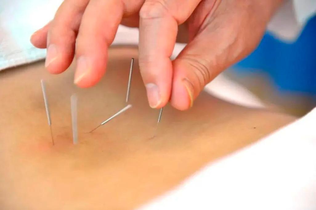 浙江省中医院针灸丰胸