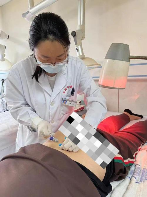 浙江省中医院针灸丰胸