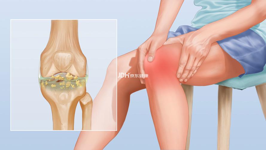 痛风会发生在膝关节吗