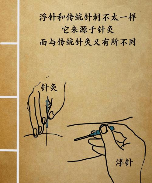 浮针和针灸有什么区别