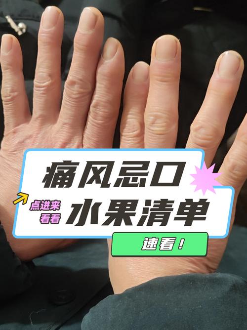 痛风吃什么水果零食好