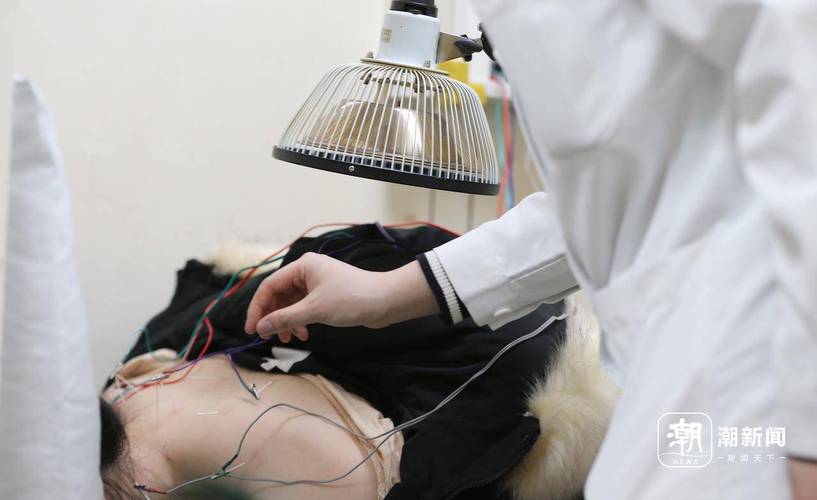 武汉市中医院针灸减肥