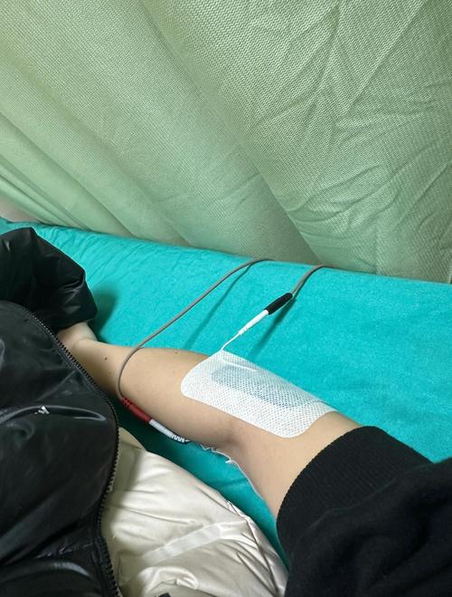 温县陈桂兰针灸怎么样