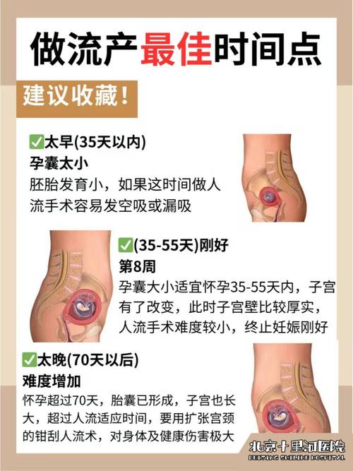 哪家医院做人流比较安全