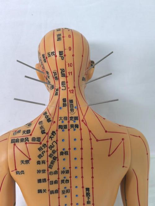 颈椎病用针灸治疗如何