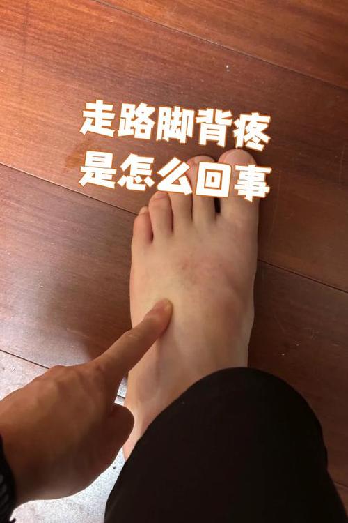 痛风会不会引起脚背肿