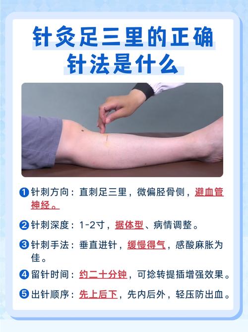 西安长安区哪儿针灸好