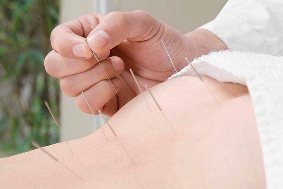 针灸可以调节内分泌吗