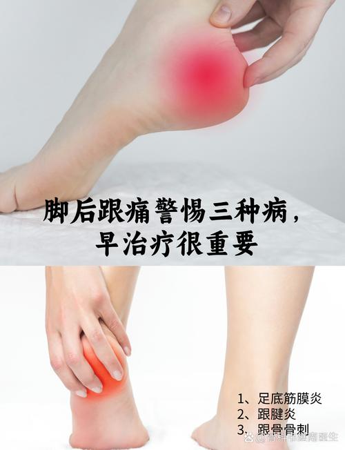 痛风脚痛多长时间能好