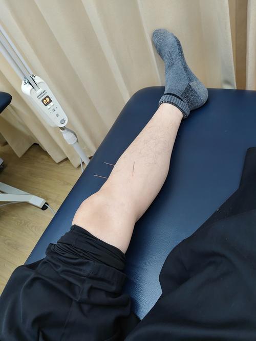 腿凉应该针灸什么血位