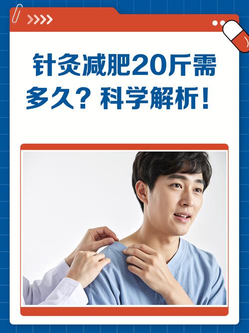 针灸减肥一次需要多久