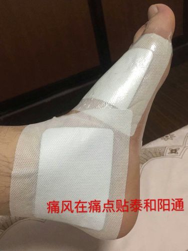 苗老师专治痛风微信号