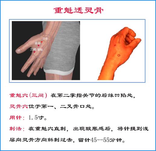 针灸可以治疗鼻窦炎吗