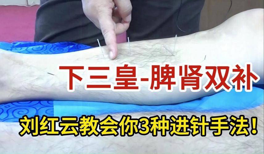 董氏奇穴针灸全集视频