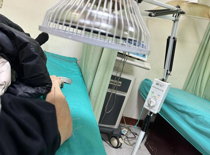 针灸可以治疗网球肘吗