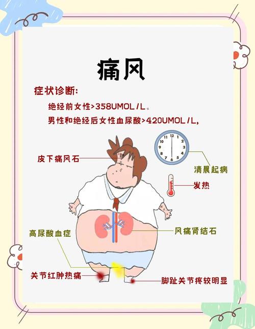 喝啤酒喝痛风有关系吗