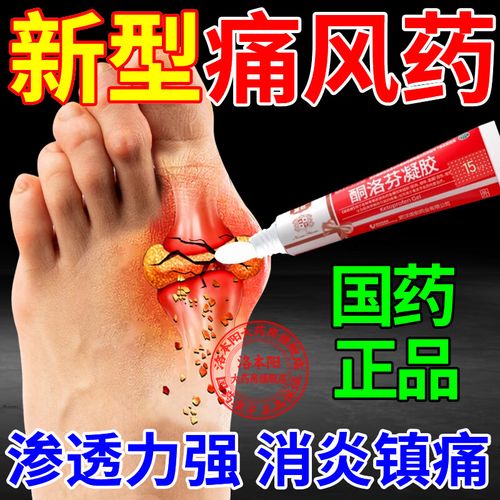 大母脚趾痛风吃什么药