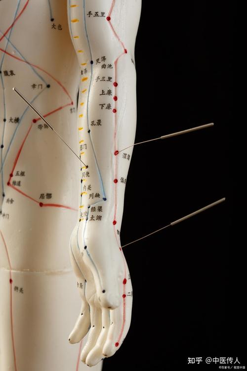 肱骨外上髁炎针灸穴位