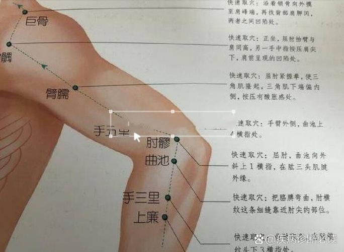 肱骨外上髁炎针灸穴位