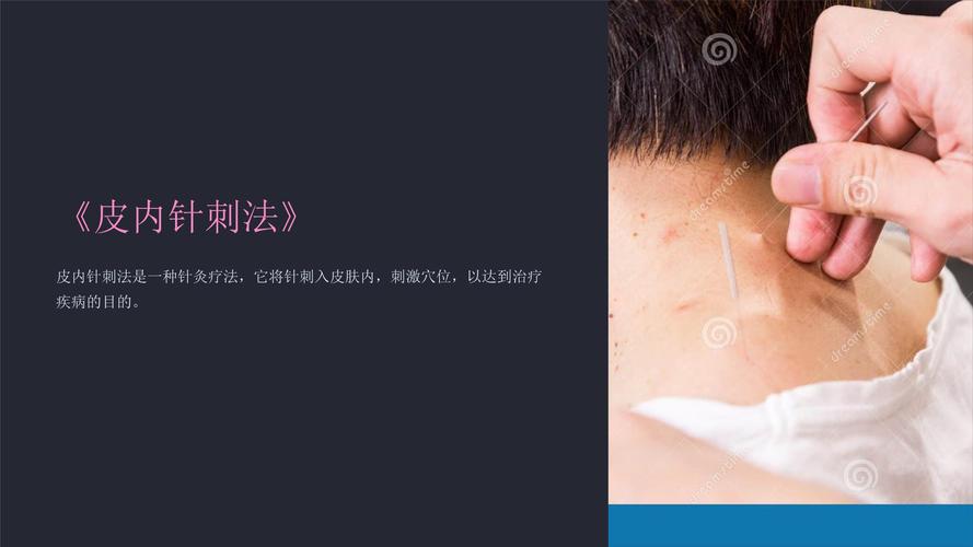 针灸治大小便失禁文库