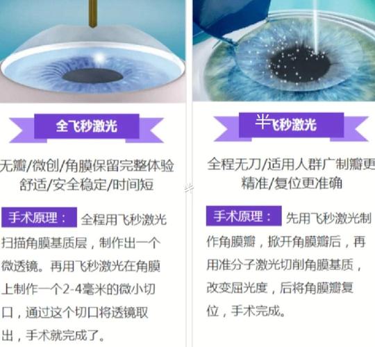 高度近视激光手术安全吗