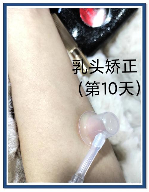 乳头内陷矫正手术安全吗